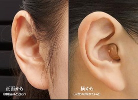 オンキョー「耳穴型デジタル補聴器OHS-D21」